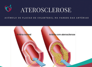 O que é Aterosclerose?